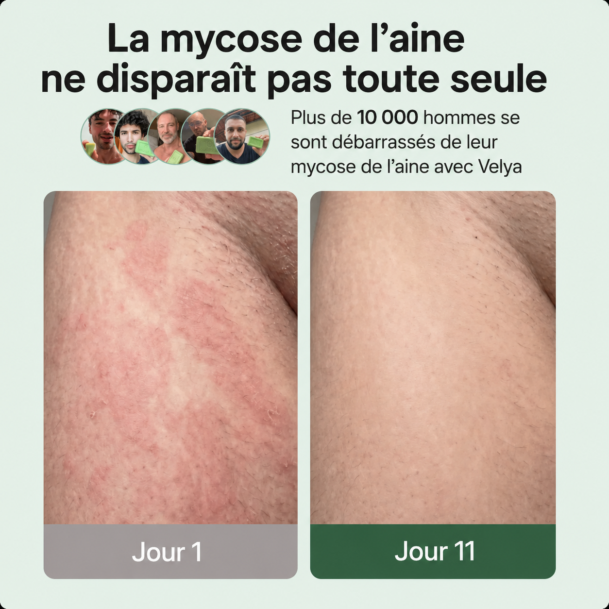 Savon Antifongique Velya®