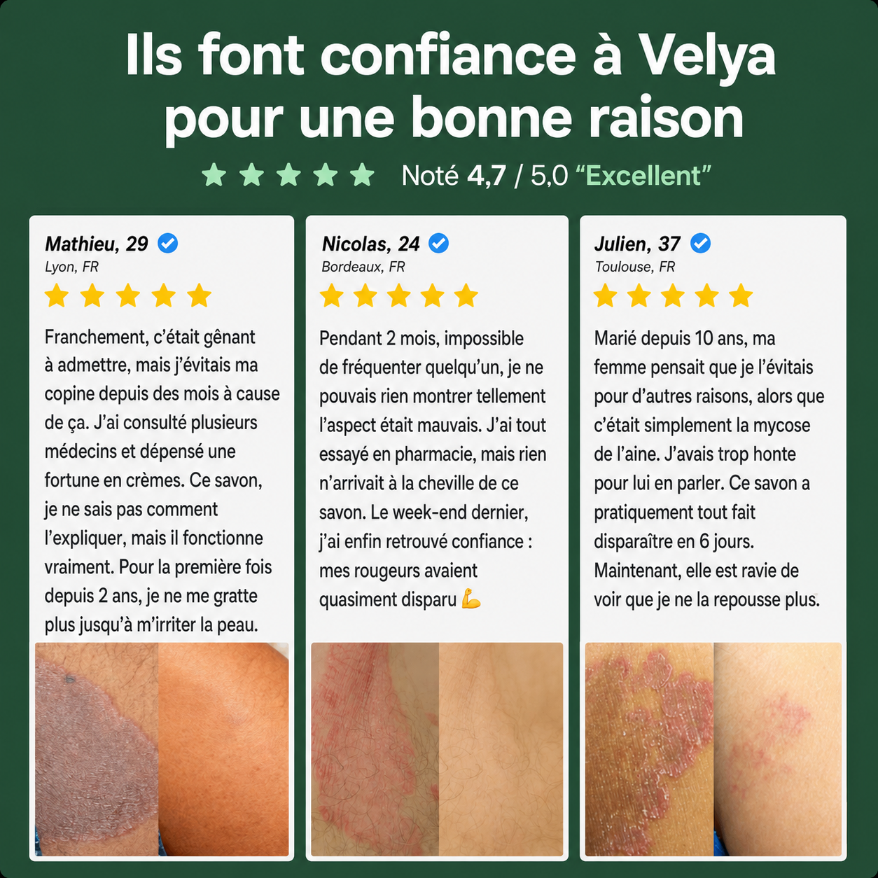 Savon Antifongique Velya®
